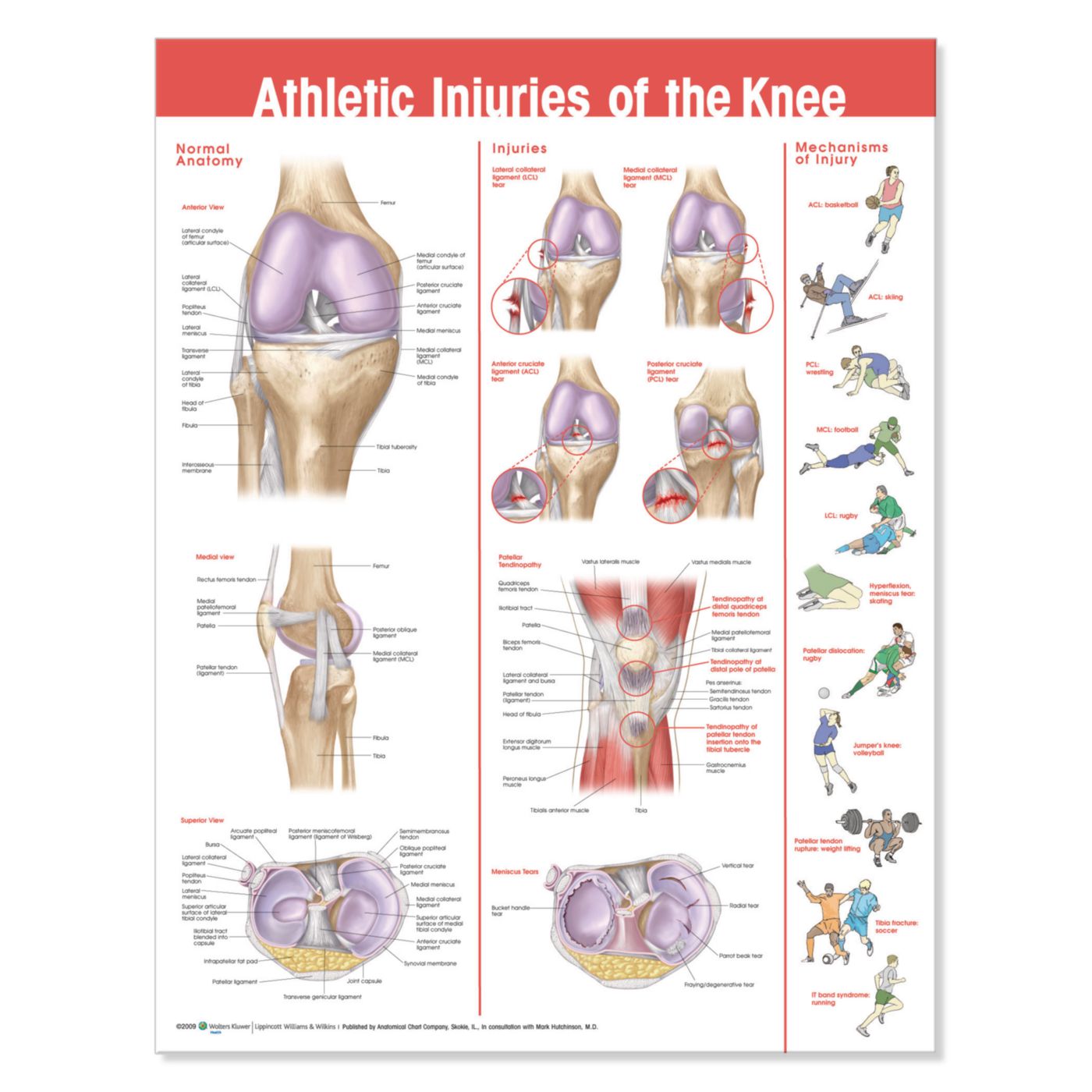 Athletic Injuries of the Knee Chart Performance Health