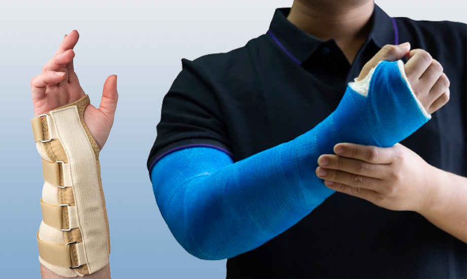 Casts and Braces